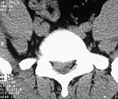 Mikroskopische Operationen